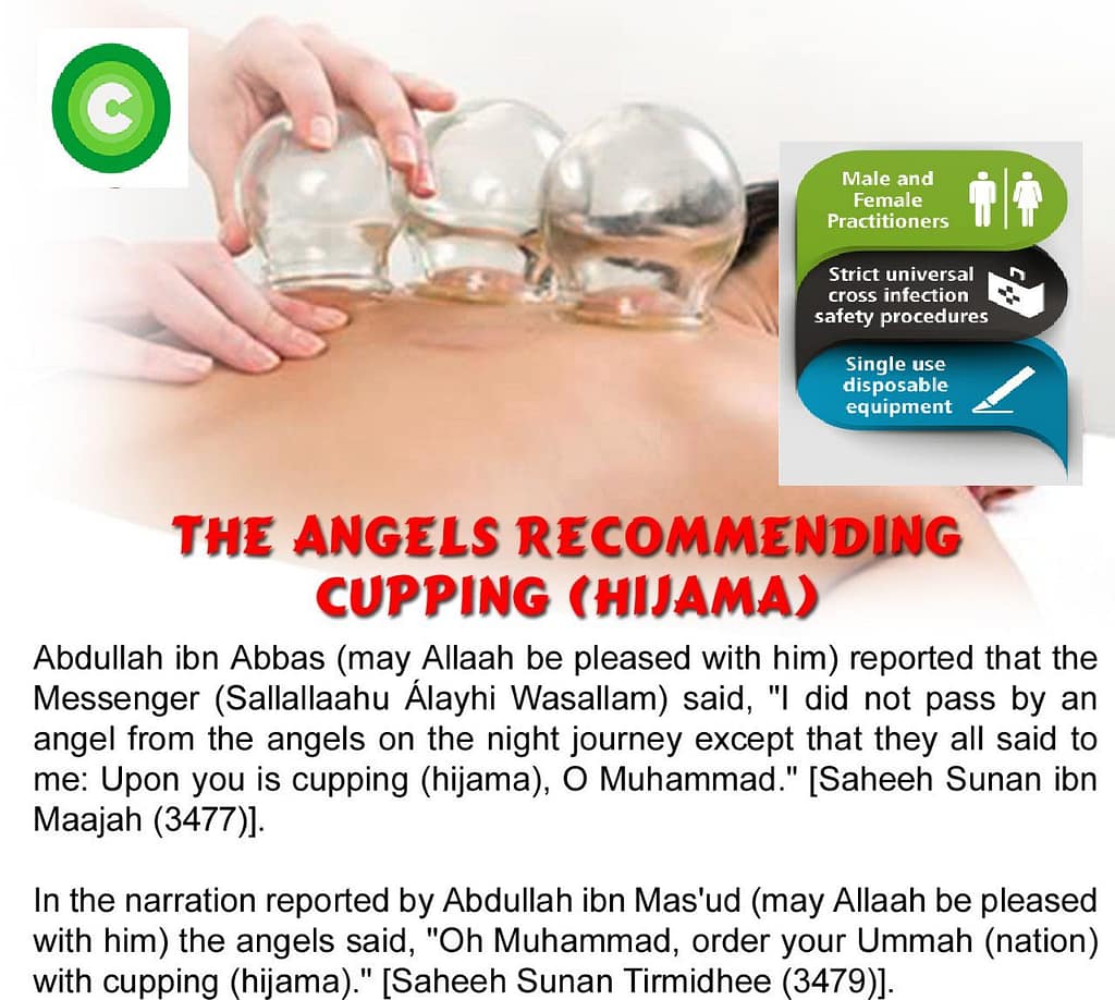 Hijama & Cupping angle recommended hijama
