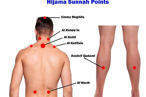 Hijama Sunnah Points on Body