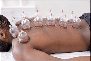 Read more about the article Hijama FAQ’s