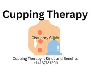 Read more about the article Cupping Therapy