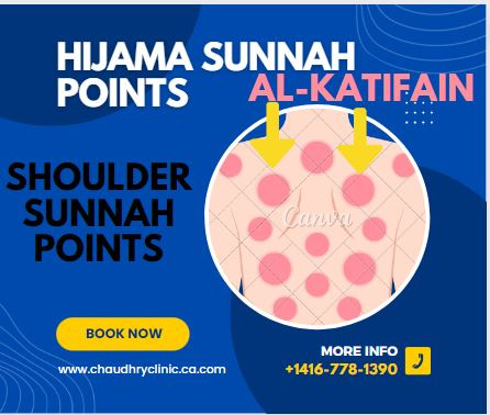 Hijama sunnah point on body