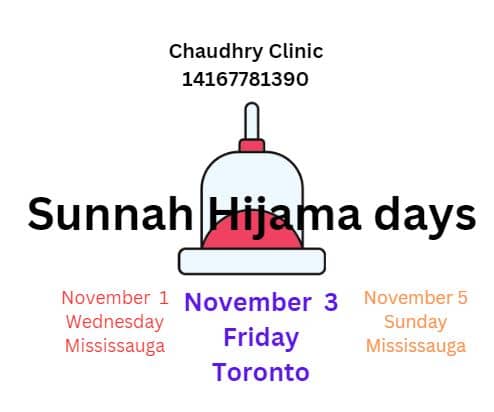 You are currently viewing Sunnah Hijama Days November 2023
