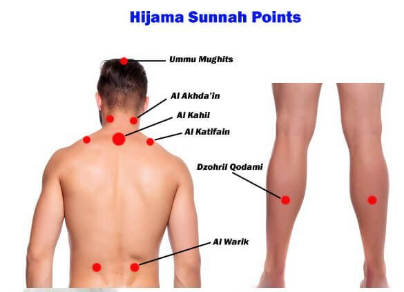 You are currently viewing Hijama Sunnah Points on Body