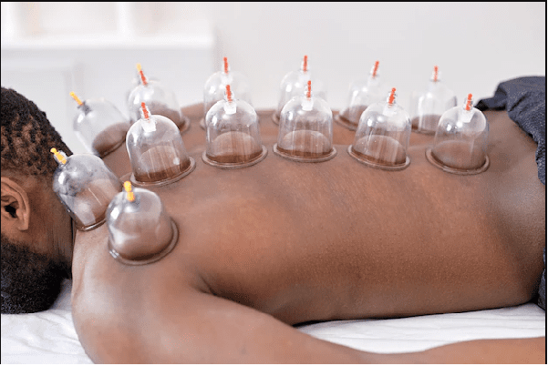 You are currently viewing Hijama FAQ’s