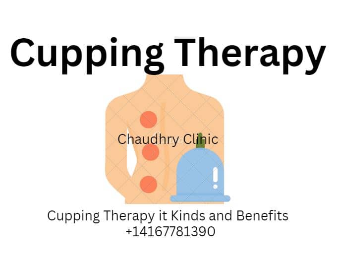 You are currently viewing Cupping Therapy