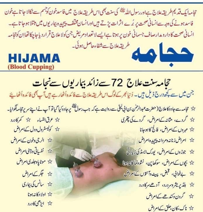 Hijama Urdu