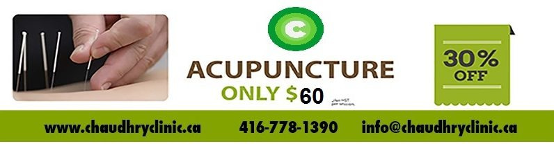 Acupuncture for sale